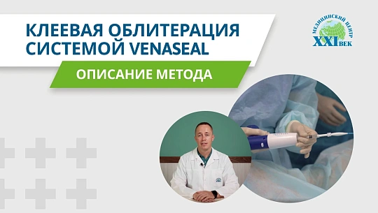 Клеевая облитерация системой VenaSeal