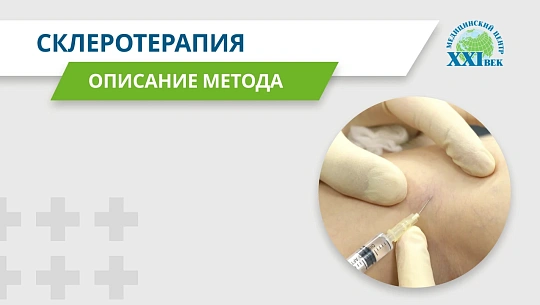 Склеротерапия: лечение варикоза и сосудистых звездочек
