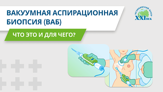 Вакуумная аспирационная биопсия (ВАБ)