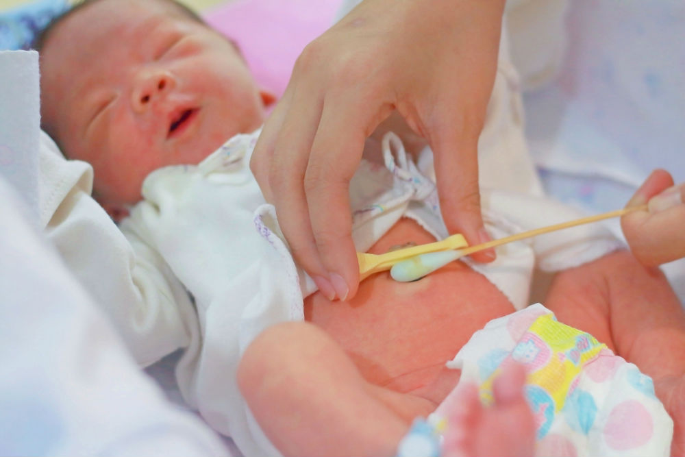 уход за пупочной ранкой