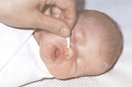 Уход за носовыми ходами